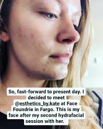 Hey Girlies! As I'm trying to become more active