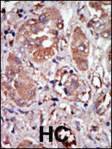 Check spelling or type a new query. Pkr Prkr Antibody C Term Purified Rabbit Polyclonal Antibody Pab Ihc P Wb E Buy Now Abcepta