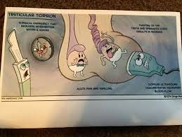 Testicular Torsion Ultrasound Humor Radiology Humor Diagnostic Medical Sonography
