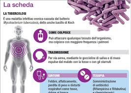 Nel 1882 e chiamato perciò << bacillo di koch >>. Tubercolosi Focolaio Di Tbc In Una Scuola A Treviso Ora Sotto Controllo Sanita Ansa It