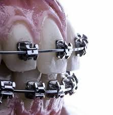Centro De Ortodoncia Y Ortopedia Dentomaxilofacial Poza Rica