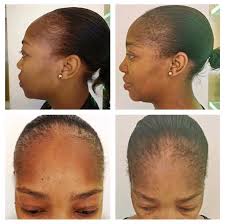 Dr p aesthetic lifestyle centre is a medical aesthetic and lifestyle experience based in hyde park corner, johannesburg. Dr P Aesthetics Lifestyle Centre Home Facebook