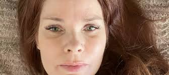 Hallux valgus: Advarer: