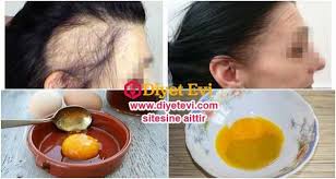 Sac Dokulmesi 5 Diyetevi Com Hair Growth Faster Hair Loss Healthy Hair Tips