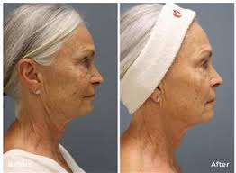 Reviews of Coco Beauty Bar & Medical Spa