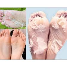 For those who haven't heard of baby foot ($25, babyfoot.com), it's an exfoliating foot peel that comes in the form of plastic booties. Baby Foot Exfoliant Foot Peel Techizio