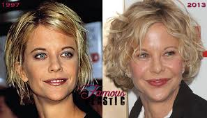 Has meg ryan had plastic surgery? Meg Ryan S Before And After Plastic Surgery Photos Should Warn People It Can Also Fail Thirds Orange