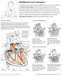 Childhood Heart Murmurs Pediatric Nurse Practitioner Pediatric Nursing Nicu Nurse