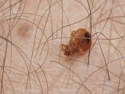 Where Do Bed Bugs Hide? | Terminix