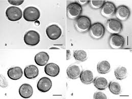 Image result for Berkheya spekeana