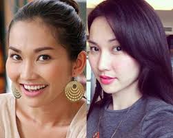 Cơn sốt làm đẹp mang tên sửa mũi đang lan rộng đến mức nào?