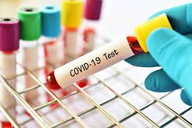 In january 2020, the united states centers for disease control and. Cdc Americane Ockovani Proti Koronaviru Sars Cov 2 Se Mohou Schazet Alespon V Domacnostech Vtm Cz