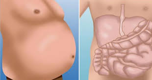 How to get rid of bloated tummy. The Reasons Why You Have Bloated Stomach And How To Get Rid Of It Pixelated Planet