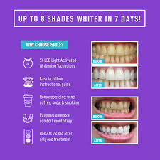 Teeth whitening will not produce paper white teeth like seen in the movies this is a result of having the surface of the teeth replaced with porcelain veneers. Ismile Teeth Whitening Kit Ismile Whitening