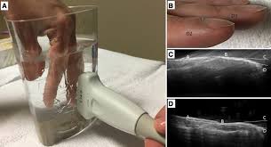 Image result for Digital Clubbing