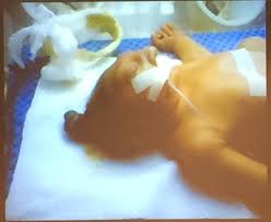 202 likes · 1 talking about this. Transcend Media Service Unnecessary Suffering The Legacy Of Depleted Uranium