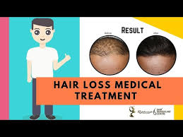 Many medical professionals initially rely on supplements for hair loss. Hair Loss Medical Treatment In India Genetic Androgen Stress