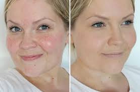Old Japanese Recipe Do This Once A Week And You Will Look 10 Years Younger Flawless Face Makeup Younger Skin Younger Looking Skin