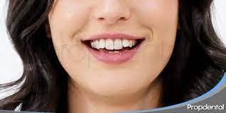 Dientes Torcidos Factores Que Pueden Causar Los Dientes Torcidos