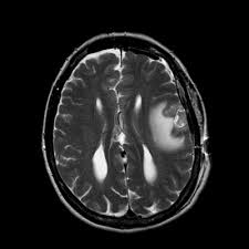 Dicom bill of lading pdf : Osirix Dicom Viewer Dicom Image Library