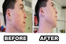 makeup for men cover acne scars
