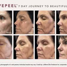 What is the difference between a medical spa and a regular spa? Aesthetic Laser Center Of Seattle Women Owned 11 Photos 23 Reviews Laser Hair Removal 509 Olive Way Seattle Wa Phone Number Services Yelp