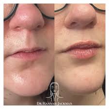 Image result for Lip Exam