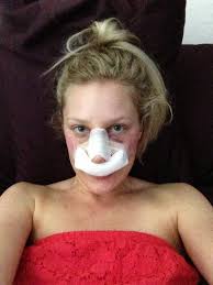 Brian Hass, MD, Board Certified Plastic Surgeon