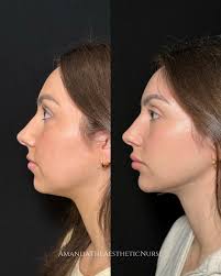 Amanda Solar BSN, RN