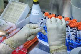 La l425r e la e484q. Coronavirus Primeiro Caso Da Variante Indiana E Confirmado No Parana Agencia Estadual De Noticias
