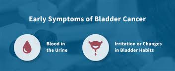 Women with uterine cancer may experience the following symptoms or signs. Can Recurrent Uti Symptoms Be A Sign Of Cancer Cxbladder