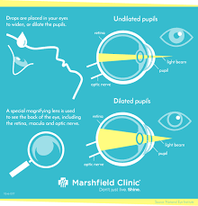 eye exam dilation alternative