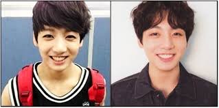 2013 2018 To All Those Antis Out There Who Claim Jungkook Has Had Plastic Surgeries Plastic Surgery Jungkook Surgery