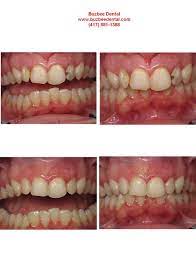 Pin On Before And After Pictures