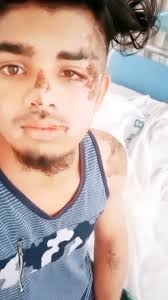 #accident 🤕… , ., Follow 👉@steeve_fan_shiva1❤️for more , ., ., ., .,  #steevejoseph #akhilcj #steeve #kerala #love #joseph #instagram #keralagram  #lithin #maheshbabu #trending #sandrahannah #tamil ...