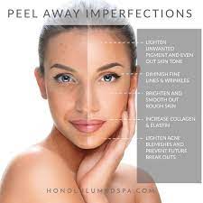 We Ve Got Progressive Chemical Peels Skin Care Treatments Chemical Peel Natural Aging Skin Care