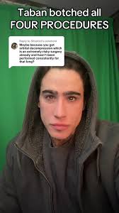 Replying to @Shootist #plasticsurgery #botched #fyp #foryoupage