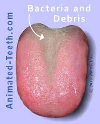 We did not find results for: How To Clean Your Tongue Using A Scraper Brush Or Spoon Pics