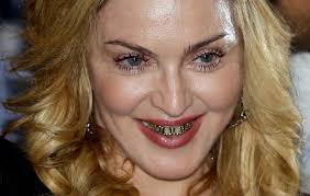 Sarah just gave us all a much. Photos Celebrities Who Have Had Braces