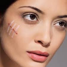 In the same way that vaginoplasty cost needs consideration given to. Surgical Scar Revision Cost In Dubai Abu Dhabi Dynamic Clinic