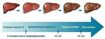 Lechenie Gepatita B V Moskve Ceny V Klinike Medelit