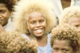 Albino Asians Black And Blonde Natural Blondes Beautiful Face
