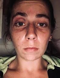 Casey Eckenrode's Instagram, Twitter & Facebook