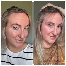 💕HAIR GUMMIES RESULTS 💕 My fab friend Leanne Murphy is absolutely loving  the gummies 💕 “I am now 6 weeks in! I have always taken a collagen  supplement since we launched and