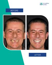 Incredible Smiles (@incrediblesmiles_is_dentist) • Instagram photos and  videos