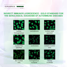 Image result for ANA Staining Pattern