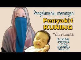Kondisi ini menyebabkan bayi membawa antibodi dari ibu yang memicu kerusakan lebih cepat pada sel darah merah bayi. Penyakit Kuning Pada Bayi Baru Lahir Cara Mengatasi Penyakit Kuning Pada Bayi Baru Lahir Youtube