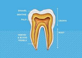 If the pain is persistent and strong, or if your teeth feel particularly weak, it is likely that your tooth's pulp is damaged and that you will need a root canal. Root Canal Perth Endodontics Kelmscott Dental