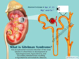 What Is Gitelman Syndrome Syndrome Genetic Disorders Metabolic Alkalosis