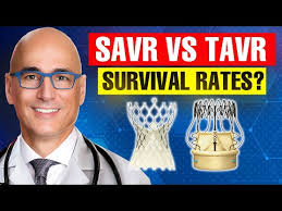 Surgical Versus Transcatheter Aortic Valve Replacement in Patients Over 65  Years Old